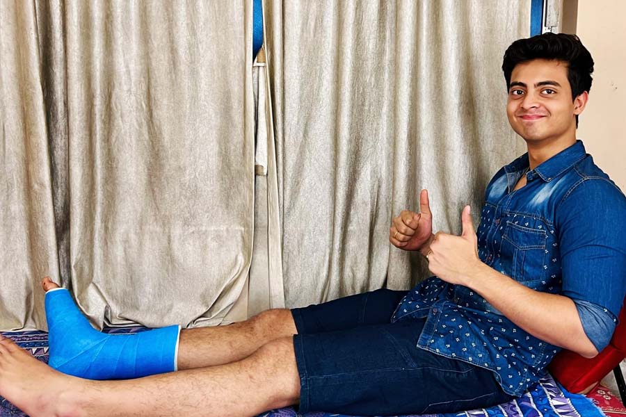 Anurager Chowa Serial Actor dibyojyoti dutta shares picture of his broken leg in instagram