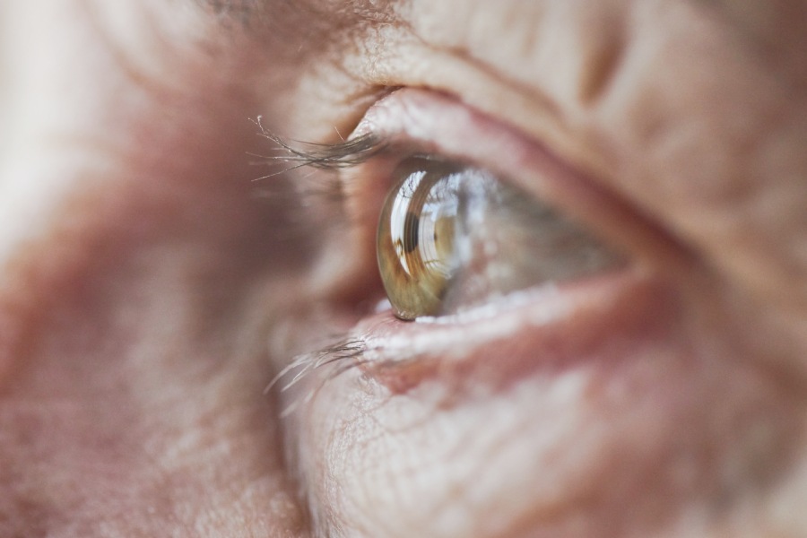 Alzheimer’s first signs may appear in your eyes 