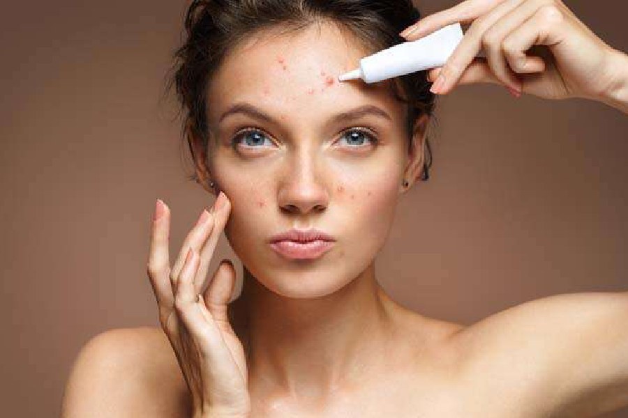know about retinol 