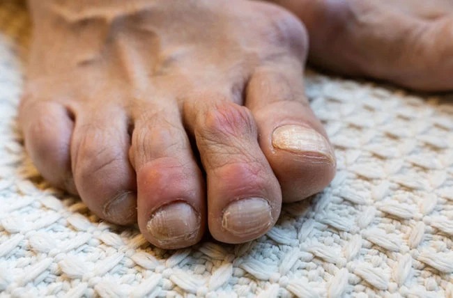 Image of foot.