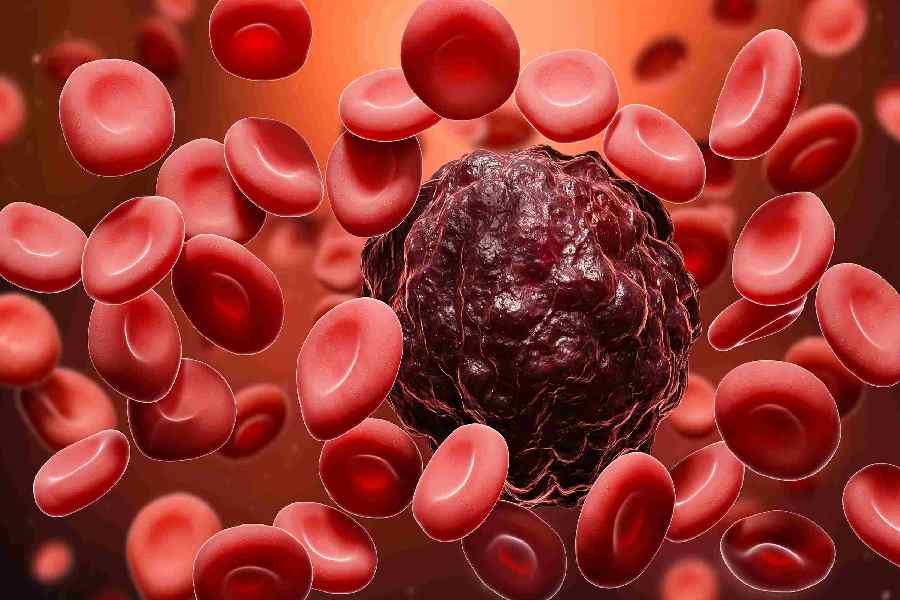 Image of blood cell.
