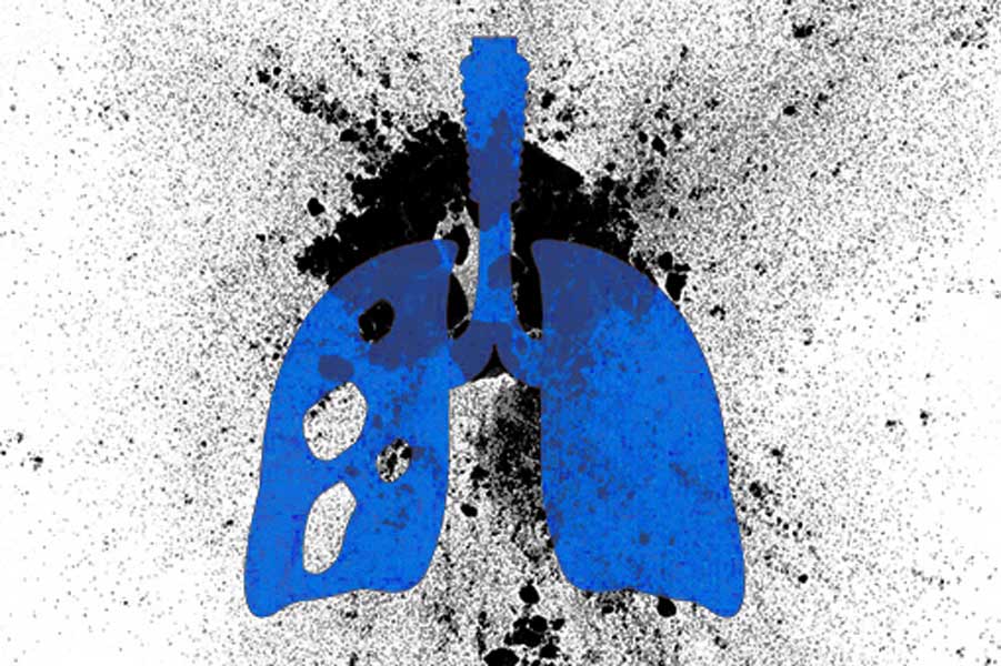 An image representing Lungs 