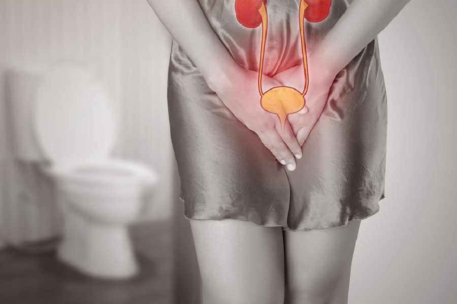 Image of gynecological disorder.