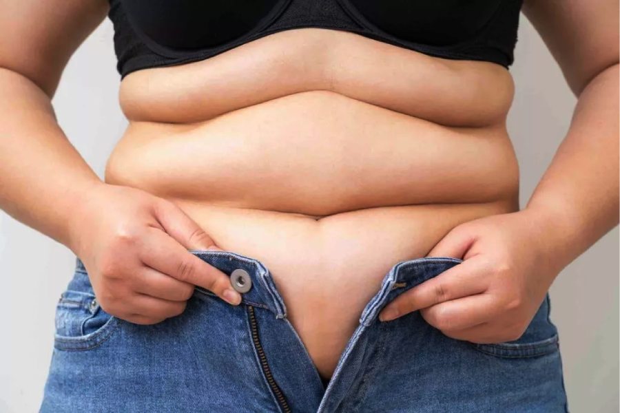 Image of belly fat