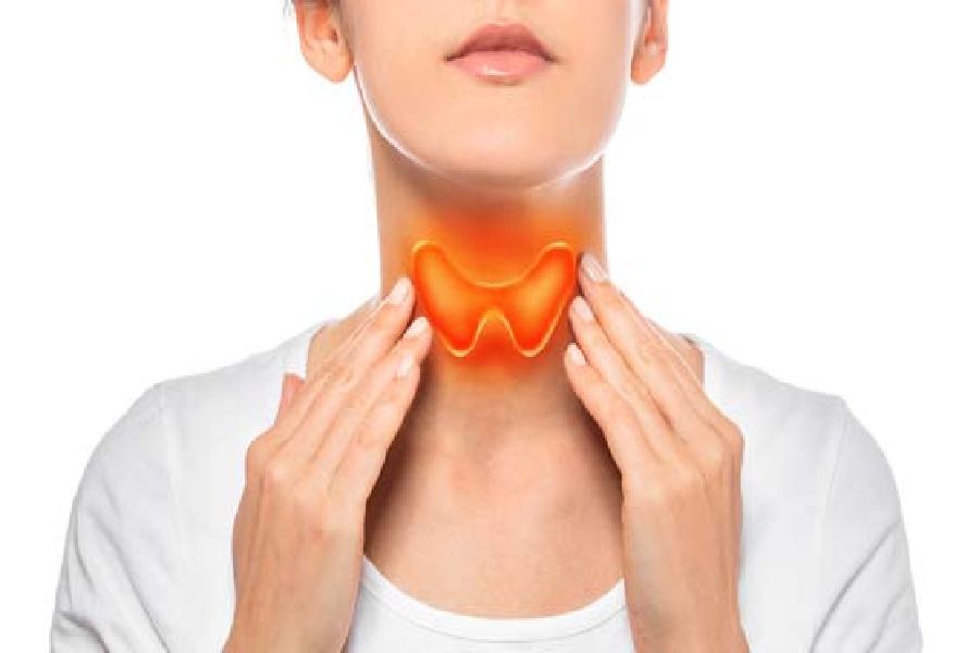 Image of Thyroid.
