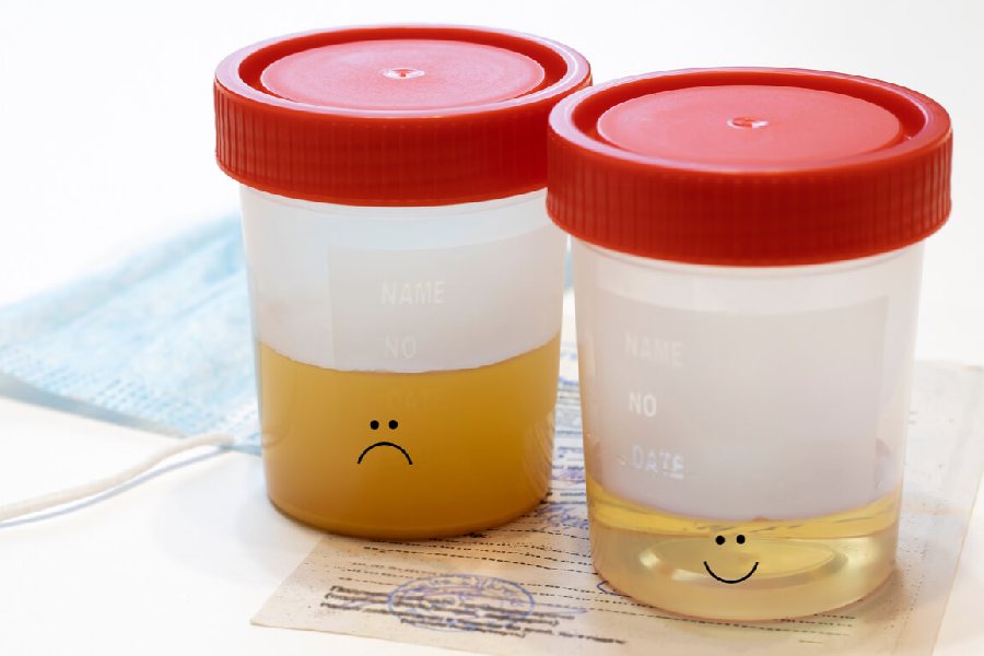 Image of urine