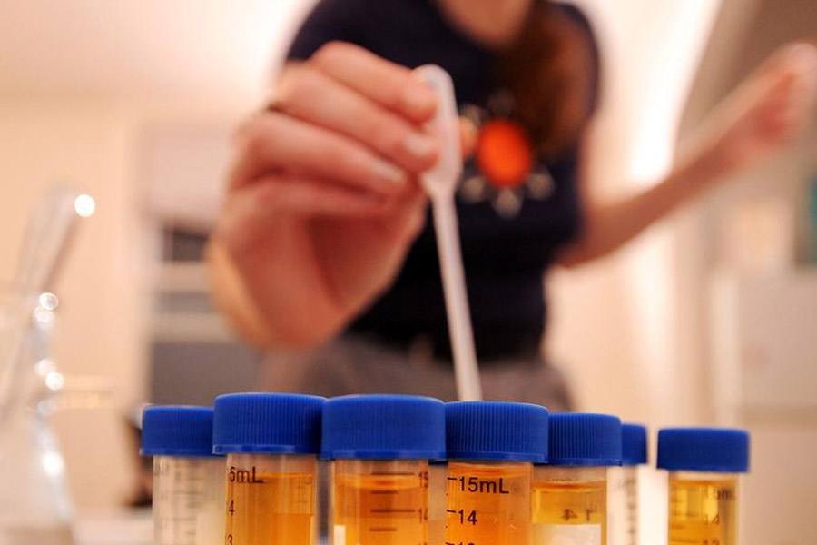 Representational picture of DNA test