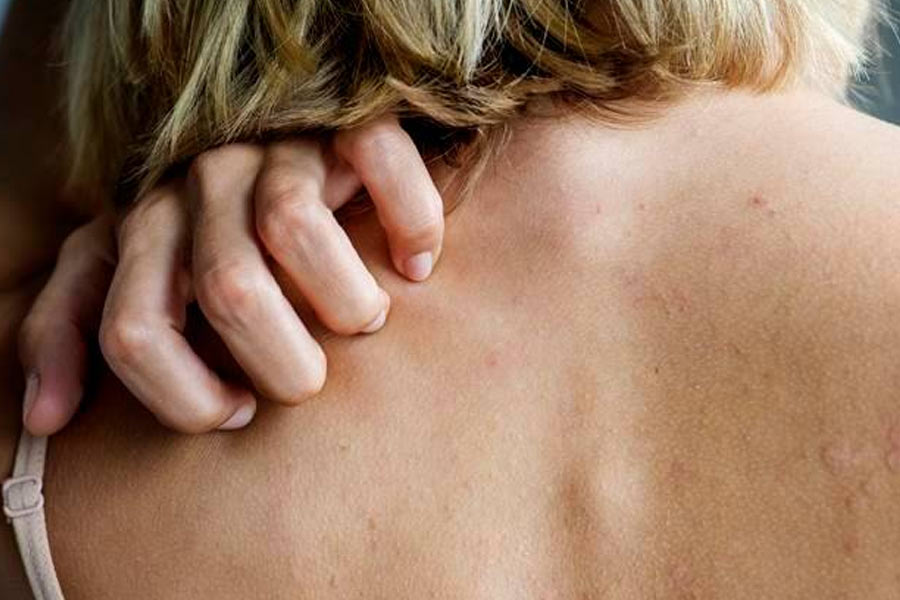 কানাঘুষো শোনা যায়, অতিথিরা নাকি হঠাৎ করেই তাঁদের শরীরে নানা জায়গায় দাগ লক্ষ করতেন। দেখে মনে হত যেন কেউ জোর করে আঁচড় কেটে দিয়েছেন। কেউ কেউ নাকি আঁচড়ানোর অনুভূতিও টের পেয়েছেন। অতিথিদের দাবি, নিজে থেকেই শরীরে প্রকট হয়ে যেত সেই দাগ।