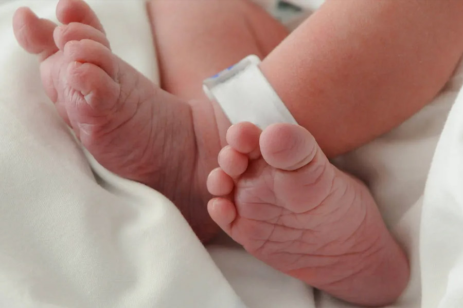 জন্মের সময় আমেরিকায় প্রতি সাড়ে ৪ হাজার শিশুর মধ্যে এক জনের এই সমস্যা দেখা যায়। তাদের মধ্যে ৪০ শতাংশেরই মৃত্যু হয় গর্ভে। যারা জীবিত অবস্থায় জন্মায়, তাদের আয়ু হয় কয়েক ঘণ্টা।