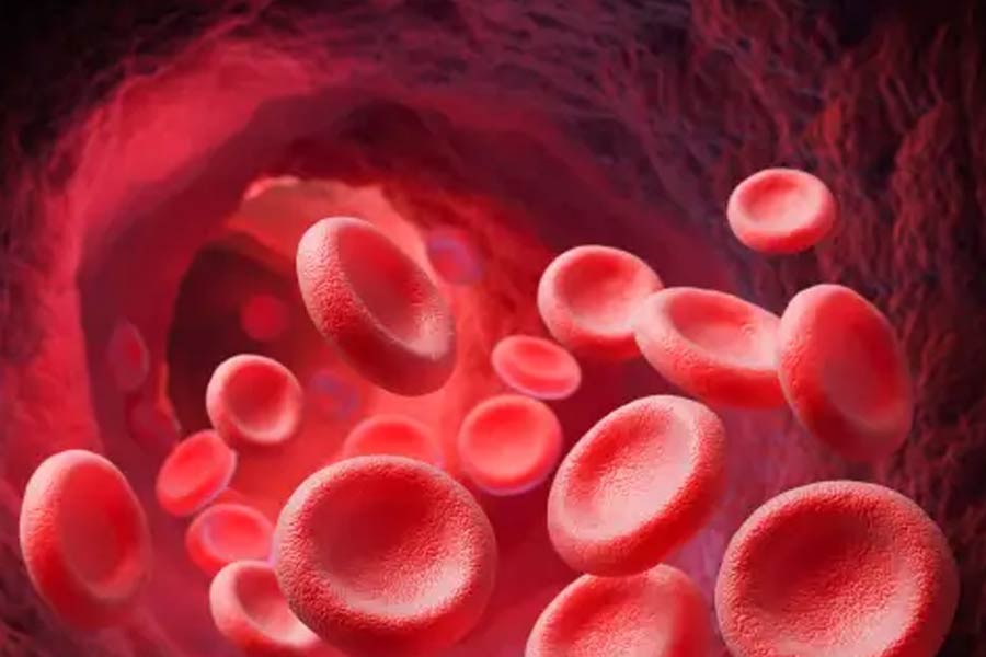 কিন্তু দেব বললেই তো কিডনি দেওয়া যায় না। দাতা এবং গ্রহীতার রক্তের কিছু বিষয়ে মিল থাকতে হয়। সৌভাগ্যবশত এমি আর অ্যান্ডির সে সব মিলে যায়।