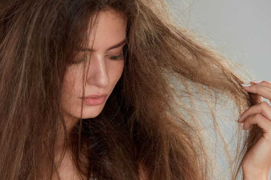 Three diet tips you need to incorporate if you are struggling with dry hair.