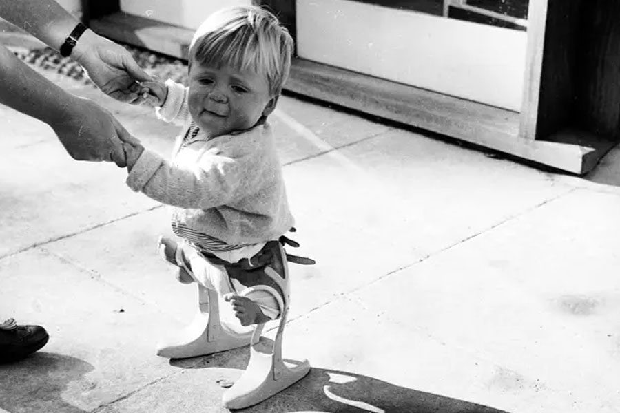 All you need to know about Thalidomide Tragedy