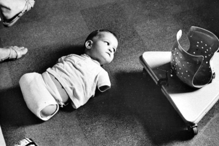 All you need to know about Thalidomide Tragedy