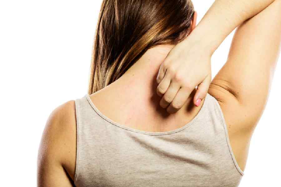 New clues revealed that can trigger an itch.