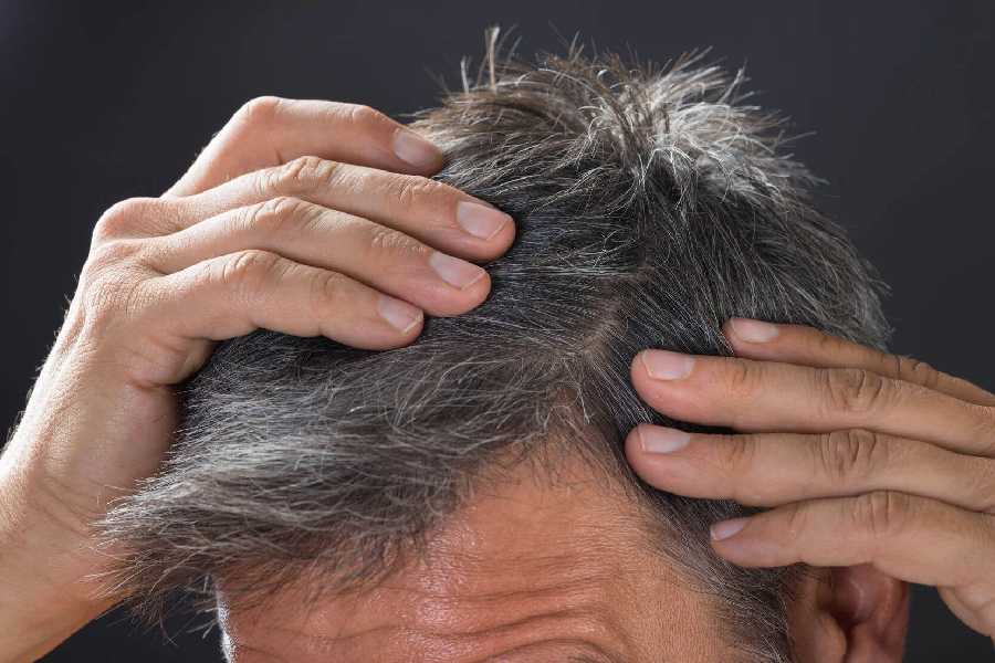 Does plucking grey hairs lead to the growth of more grey hairs.