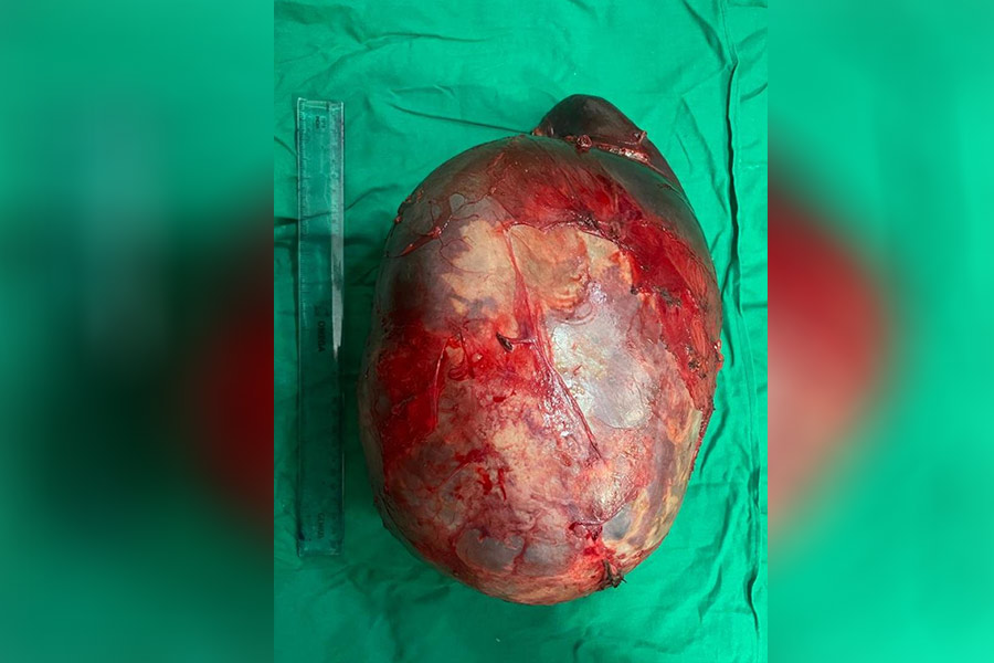 An image of the tumor