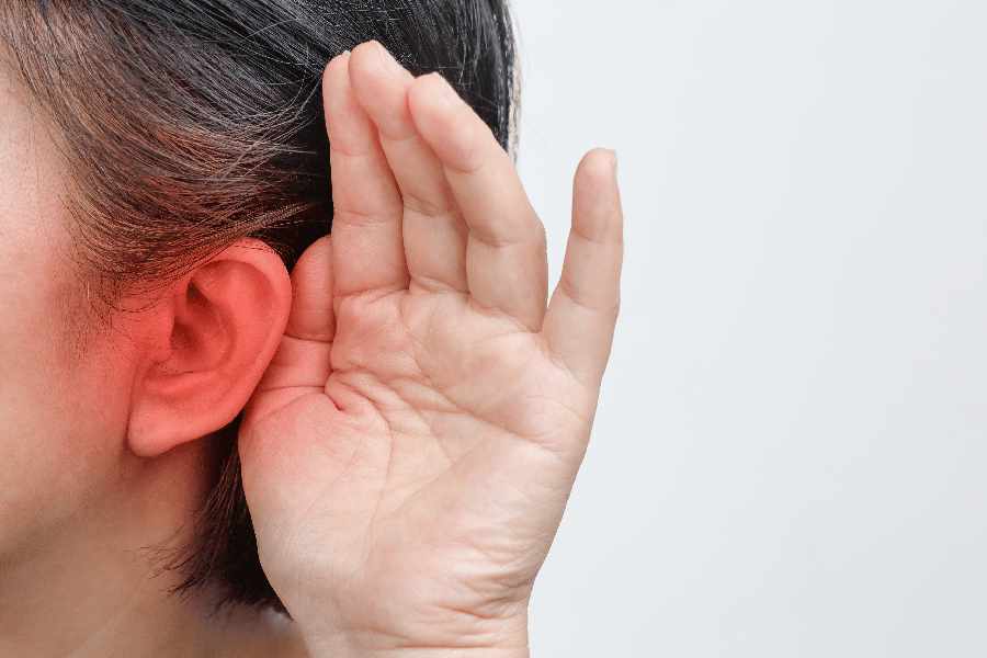 Image of Hearing Loss.