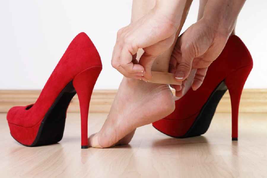 How to get relief from shoe bite.