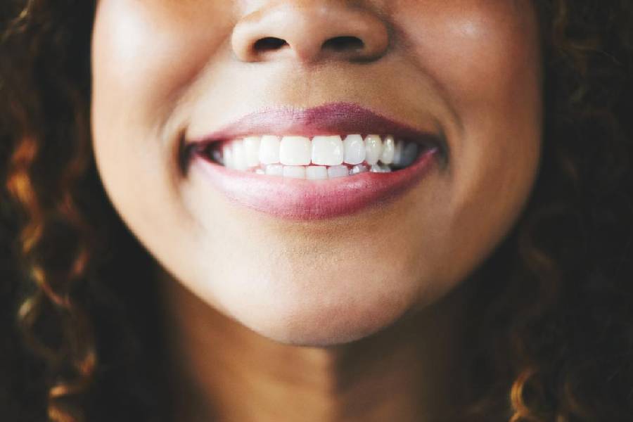Best Effective ways for teeth whitening.