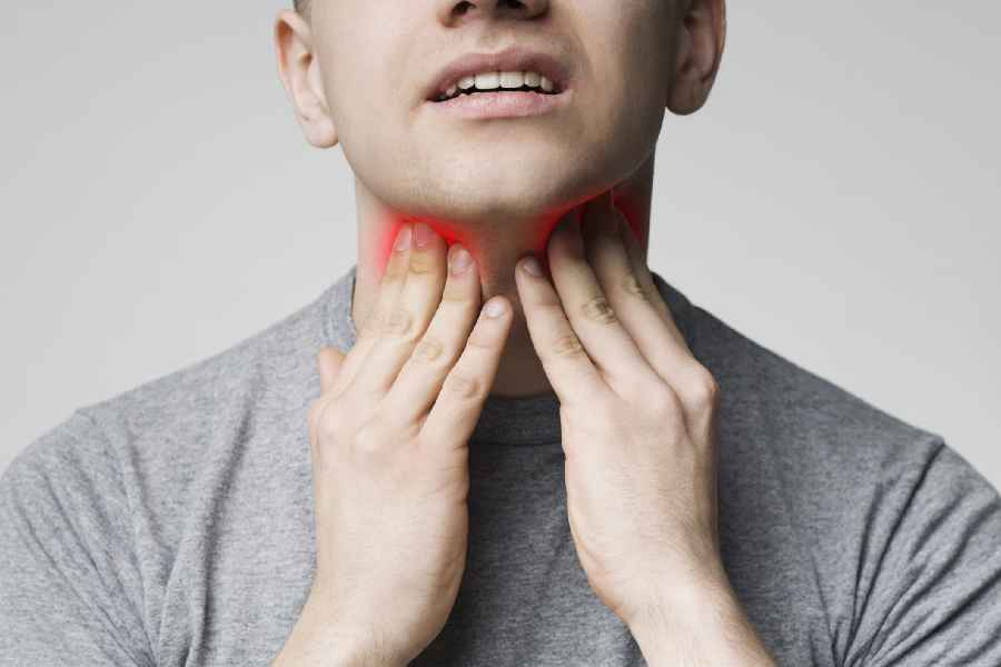Home Remedies to Heal Burning Sensation in Throat.