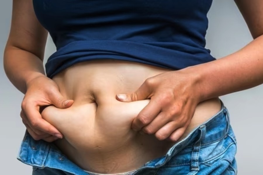 Image of belly fat