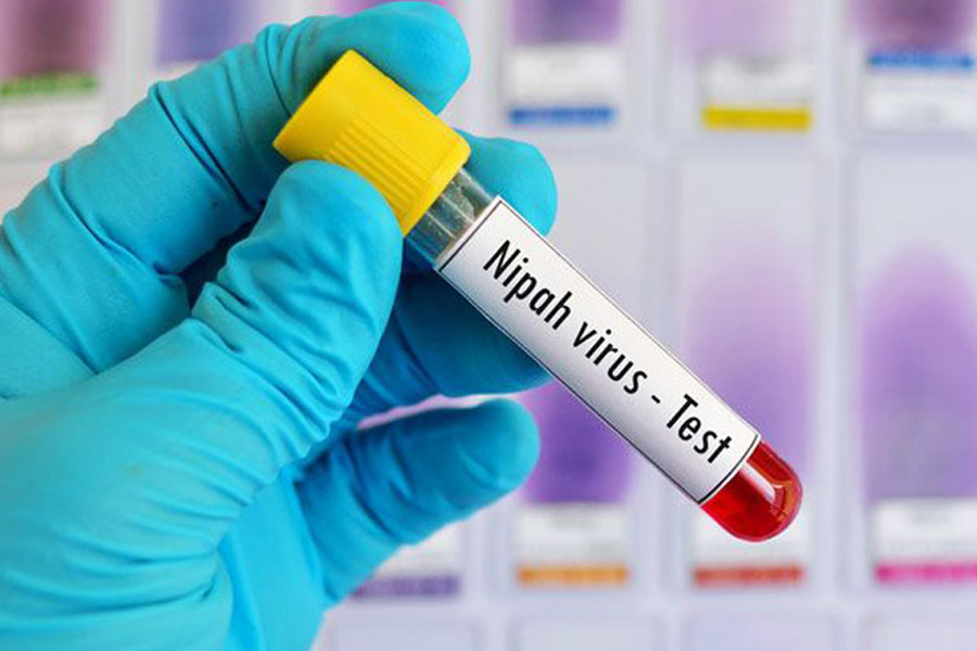 Representational Image of Nipah Virus