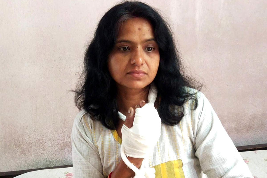 Dance teacher from Chinsurah lost her fingers in Toto accident
