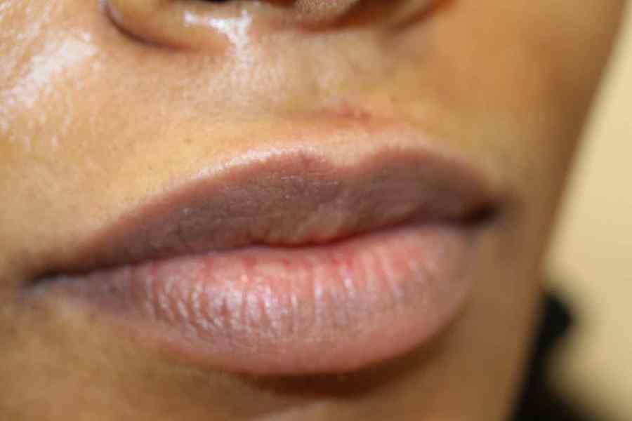 Why your lips are turning black