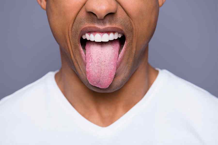 The color of your tongue can reveal these diseases