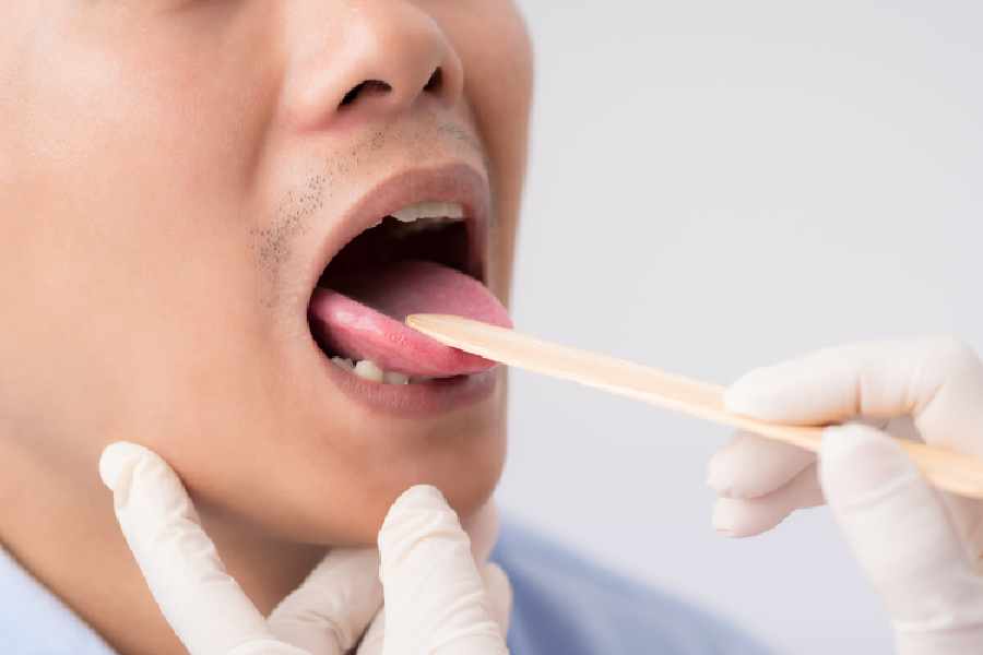 The color of your tongue can reveal these diseases