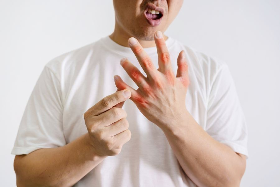 রক্তে এই অ্যাসিডের মাত্রা কমাতে না পারলে ভবিষ্যতে বিস্তর রোগ জাঁকিয়ে বসতে পারে। 