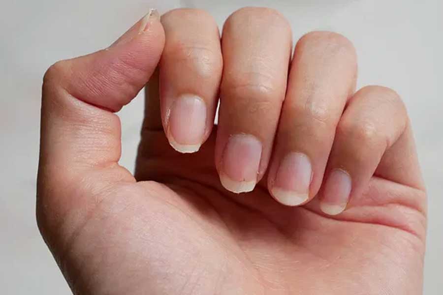 A person\\\\\\\\\\\\\\\'s nails can tell a lot about him and the white spots appearing on the nails indicate his future