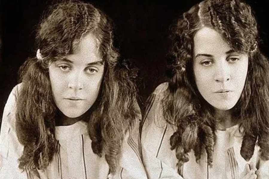 image of hilton sisters