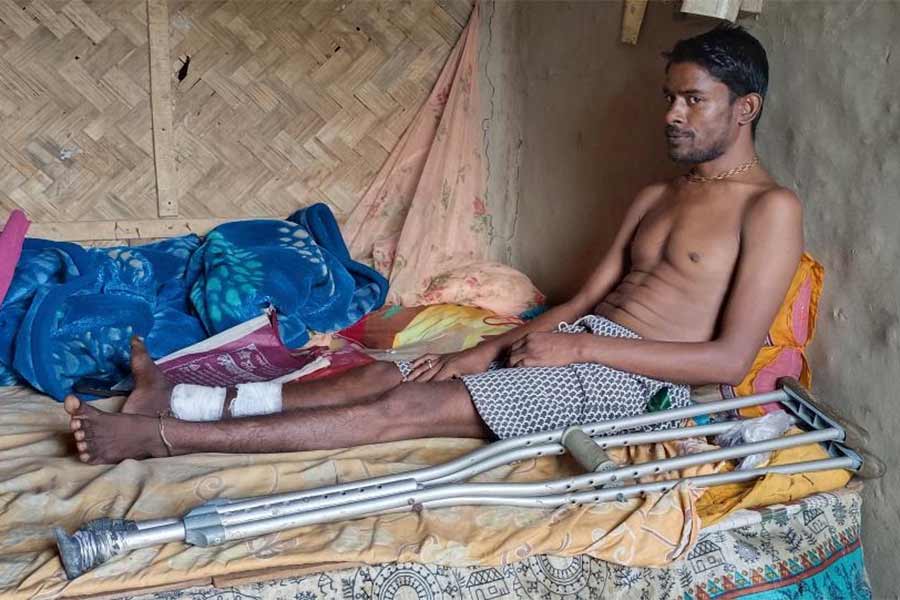 Survivor of Balasore Train accident living a miserable life with broken spine and infected left leg