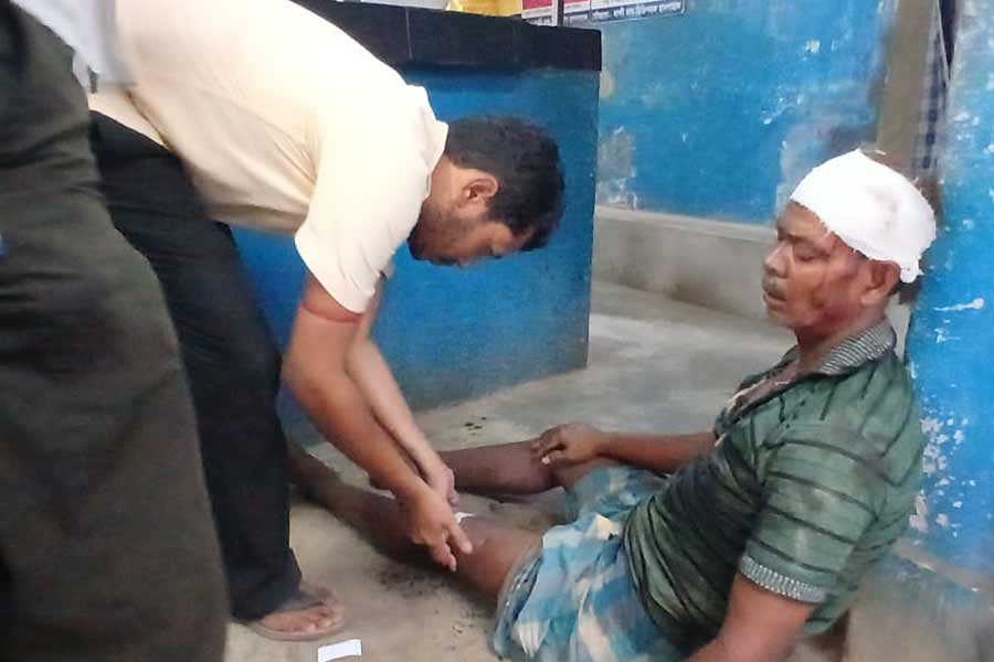 TMC clash in Murshidabad Bharatpur injures many people dgtld