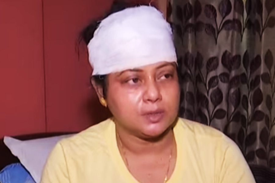 Bjp women mandal president attacked by TMC goons