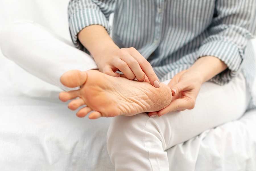 শরীরে থাইরয়েডের সমস্যা বাসা বাঁধলে পায়ের তলা অত্যধিক শুষ্ক হয়ে যেতে পারে। 