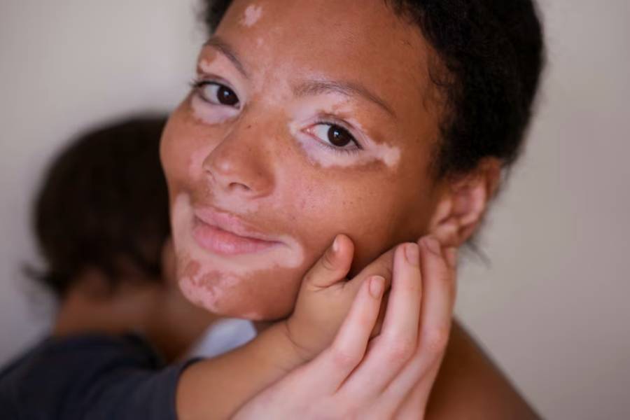 Skin discoloration can have many causes, including health conditions