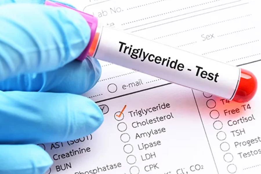 Foods that can help lower triglycerides