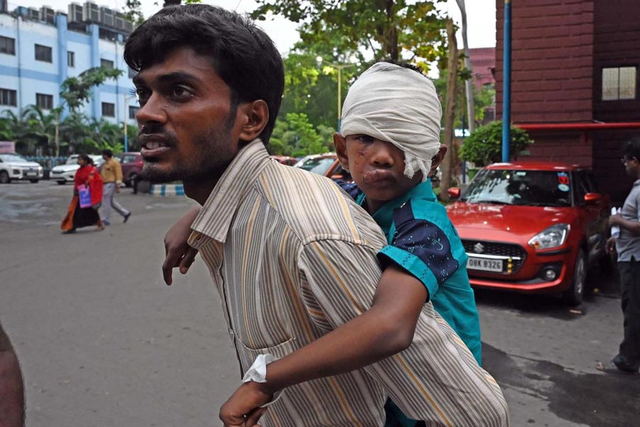 বাবার পিঠে চেপে এসএসকেএম হাসপাতালে এলেও চিকিৎসা পায়নি রায়গঞ্জের নীরব সরকার। মঙ্গলবার। 