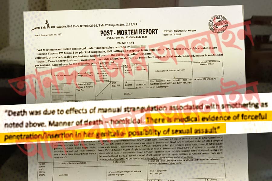 ‘যৌন হেনস্থা’র প্রমাণ স্পষ্ট, শ্বাসরোধ করে খুন চিকিৎসককে, ময়নাতদন্ত রিপোর্ট আমাদের হাতে