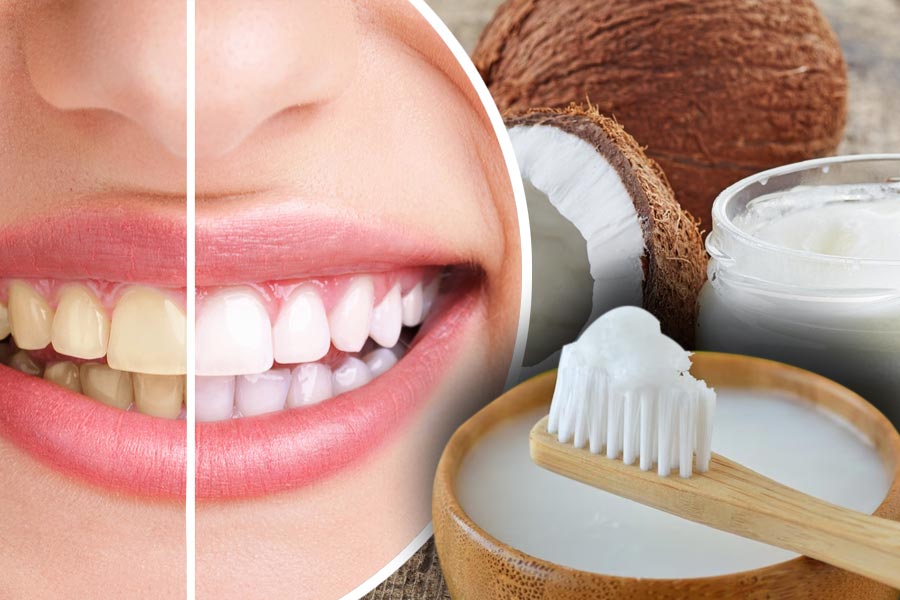 How to use coconut oil to stop tooth decay