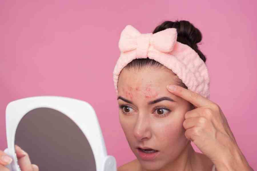 How can apple help remove forehead acne