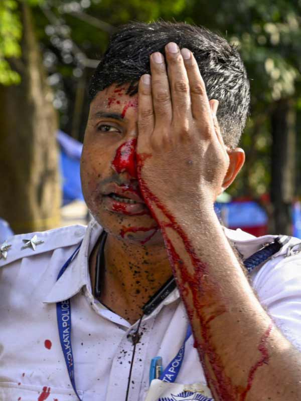 নবান্ন অভিযানে আহত পুলিশ।