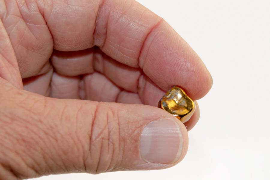 World’s expensive human tooth worth 30 lakh rupees