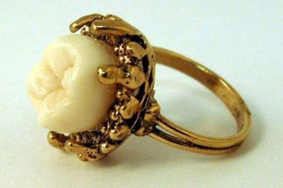 World’s expensive human tooth worth 30 lakh rupees