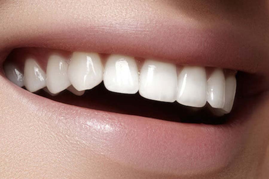 World’s expensive human tooth worth 30 lakh rupees