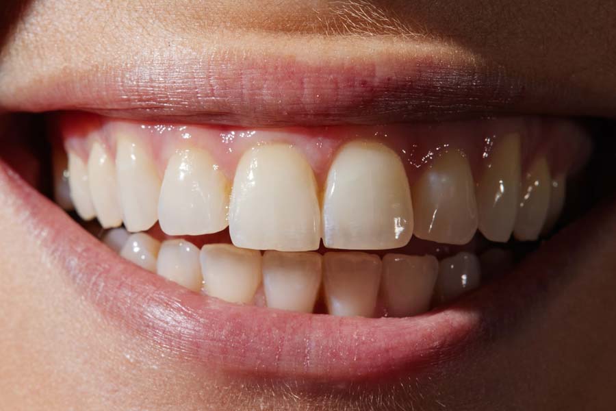 World’s expensive human tooth worth 30 lakh rupees