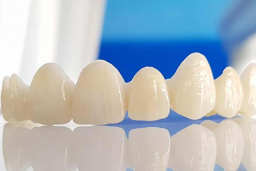 World’s expensive human tooth worth 30 lakh rupees