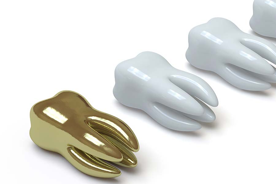 World’s expensive human tooth worth 30 lakh rupees